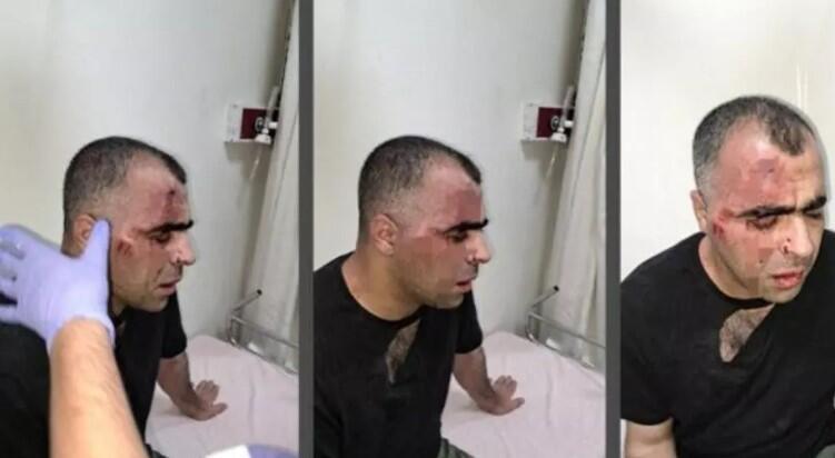 Bitlis'te gazetecinin darbedilmesinde 2 kuşkulu tutuklandı