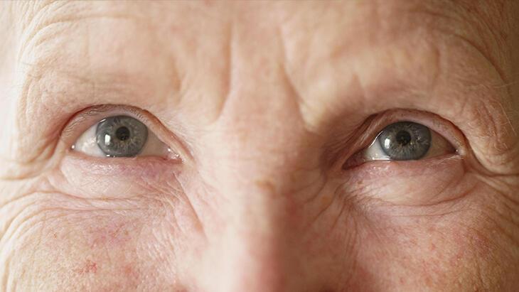 Göz ile beyin sıhhati ortasındaki çarpıcı alaka: Demans riskini 2'ye katlıyor!