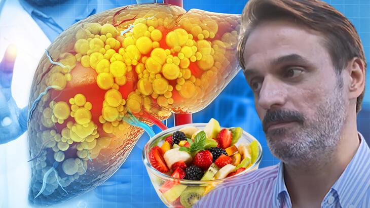Ufuk Özkan'ın karaciğerini bitiren meyve diyeti mi? Menajeri de açıkladı, gerçek çok öbür